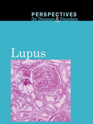 cover image of Lupus